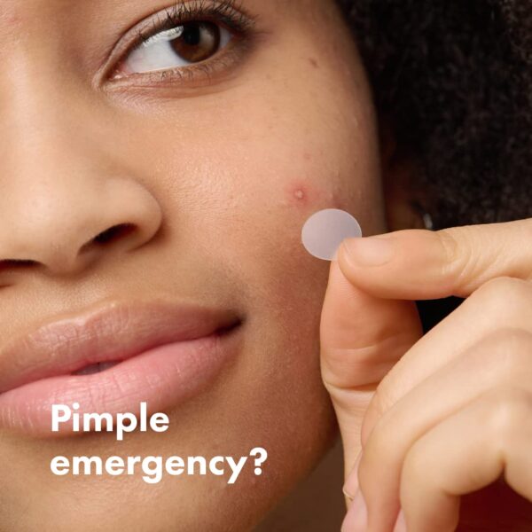 Hydrocolloid Acne Pimple Patch for Covering Zits and Blemishes in Face and Skin - Image 5